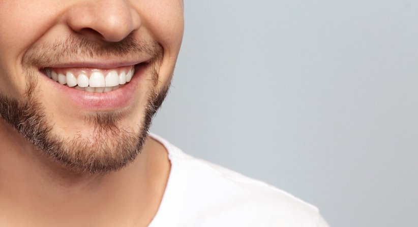 Bleaching - Dr. Oliver Steinwendtner, MM.Sc. - Zahnarzt Wien 1020