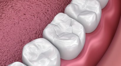 Konservierende Zahnheilkunde