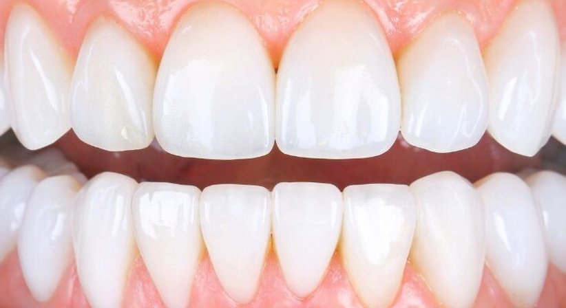 Allgemeine ästhetische Zahnheilkunde - Dr. Oliver Steinwendtner, MM.Sc. - Zahnarzt Wien 1020