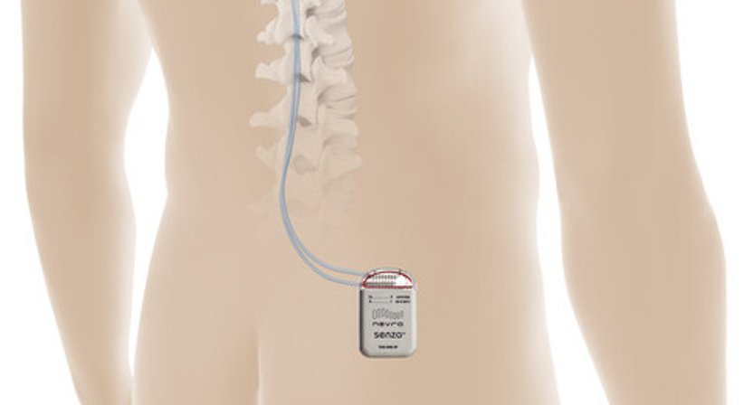 Schmerzschrittmacher / Neuromodulation - Priv. Doz. Dr. Christopher Gonano, MMMSc, MBA, MLS - Anästhesist Wien 1090