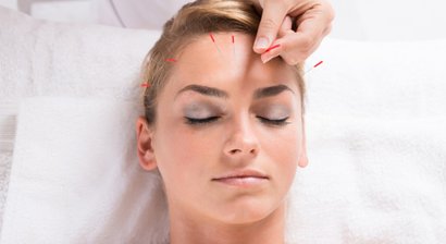 Ästhetische Akupunktur