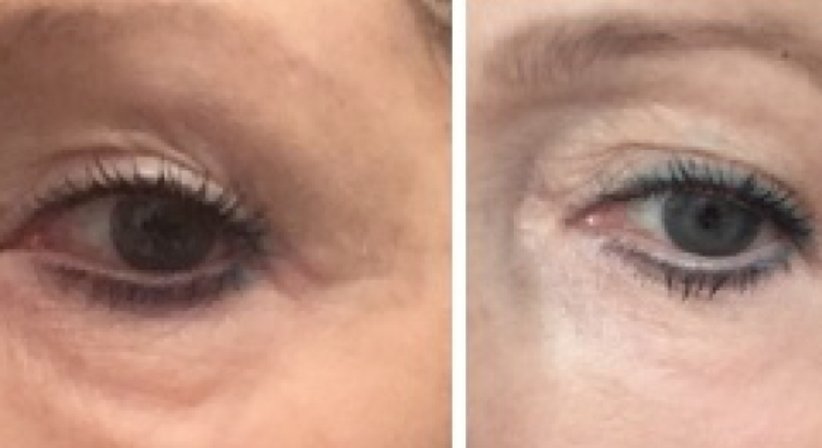 Chirurgisches Plasma - Dr. Eva Maria Zito - Praktische Ärztin Wien 1030