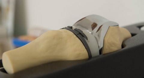 Dr. Markus Baumgartner - Orthopäde Wiener Neustadt 2700