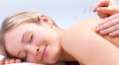 Akupunktur