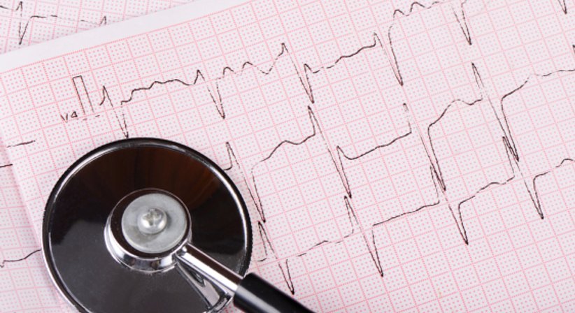 EKG - OÄ Dr. Elisabeth Leko Mohr - Lungenfachärztin Wien 1090