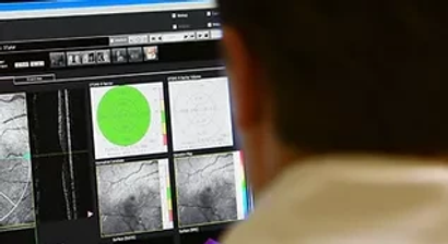 Altersbedingte Makuladegeneration (AMD)