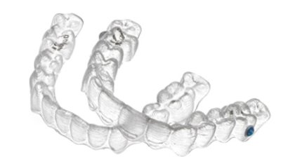 Invisalign - die unsichtbare Zahnspange