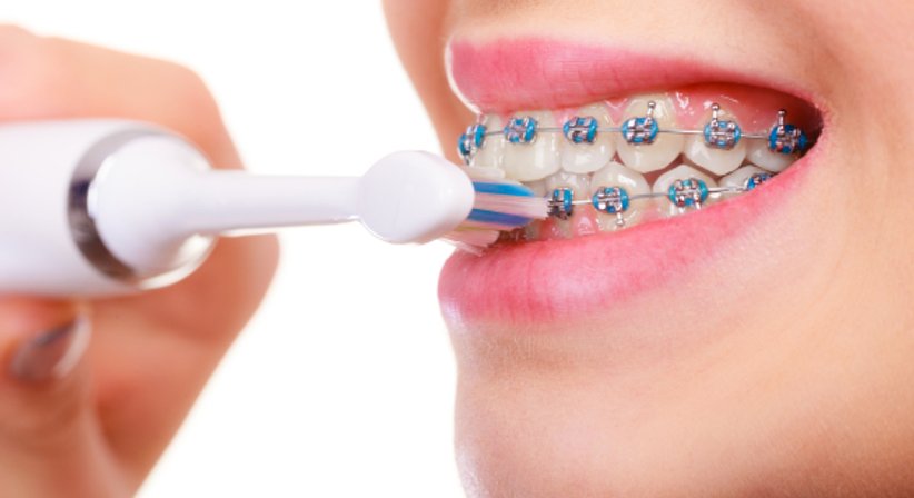 Mundhygiene / Prophylaxe - Dr. med. univ. Robert Horvath - Zahnarzt Graz 8010