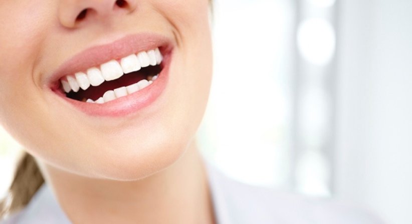 Zahnaufhellung / Bleaching - Dr. med. univ. Robert Horvath - Zahnarzt Graz 8010