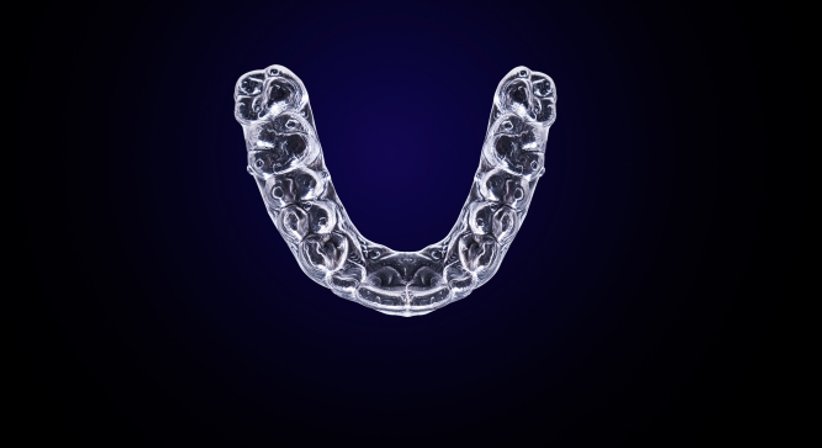 Zahnaufhellung / Bleaching - Dr. med. univ. Robert Horvath - Zahnarzt Graz 8010