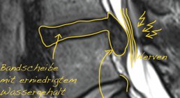 Assoc. Prof. Priv.-Doz. Dr. Klaus M. Friedrich - Radiologe Baden 2500