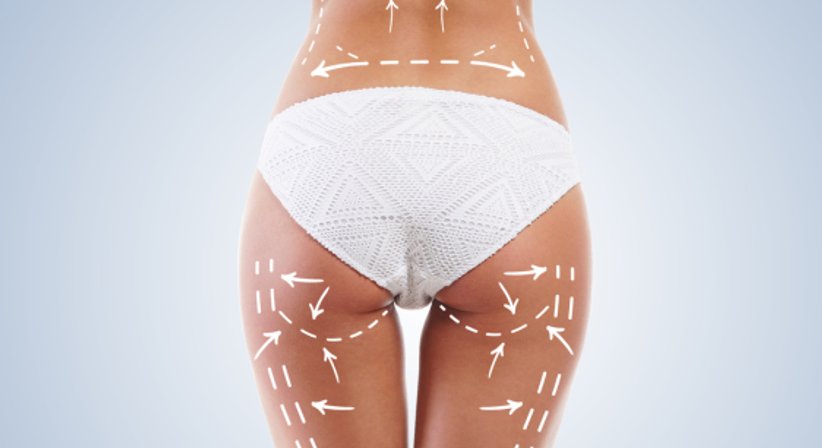 Ästhetische Chirurgie - Körper - Univ-Prof. Dr. med. Christine Radtke - Plastische Chirurgin Wien 1010