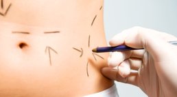 Praxis - Univ-Prof. Dr. med. Christine Radtke - Plastische Chirurgin Wien 1010