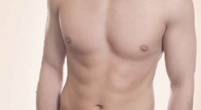 Gynäkomastie