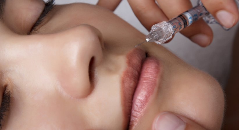 Hyaluronbehandlung - Dr. Andreas Hillisch - Plastischer Chirurg Eferding 4070