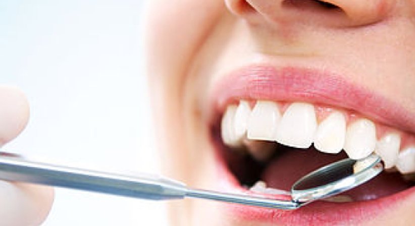 Ästhetische Zahnheilkunde - DDr. Matthias Kristoferitsch - Zahnarzt Feldbach 8330