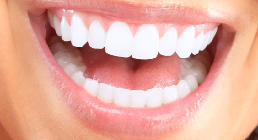 Keramik Inlays - DDr. Matthias Kristoferitsch - Zahnarzt Feldbach 8330