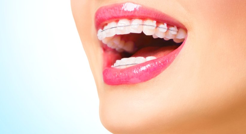 Kieferorthopädie - DDr. Matthias Kristoferitsch - Zahnarzt Feldbach 8330