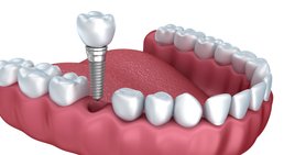 Dr. Robert Stillmann, MSc - Zahnarzt Wien 1010