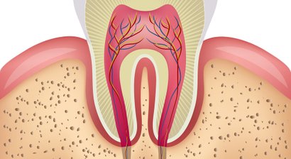 Wurzelbehandlung unter Mikroskop