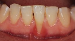 Dr. Robert Stillmann, MSc - Zahnarzt Wien 1010