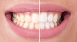 Dr. Robert Stillmann, MSc - Zahnarzt Wien 1010