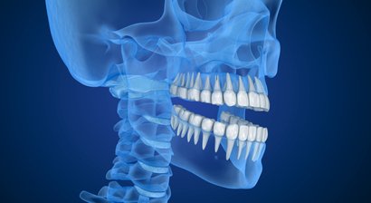 Digitale Röntgen- und DVT- Diagnostik