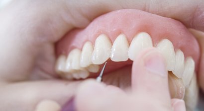 Hochästhetische Prothetiklösungen