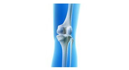 Knieprothese