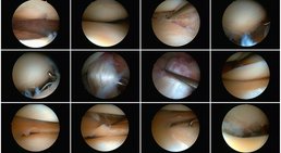 Assoz. Prof. Priv. Doz. Dr. Mathias Glehr - Orthopäde Graz 8010