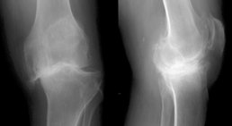 Dr. Christian Patsch - Orthopäde 4048 Puchenau