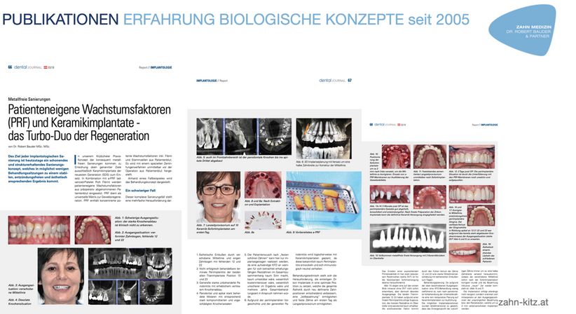 Ganzheitliche Biologische Zahnmedizin - Dr. Robert Bauder, MSc., MSc. - Zahnarzt Kitzbühel 6370