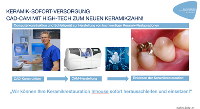 Zahnfüllung, Inlays (Amalgamsanierung, CAD-CAM)