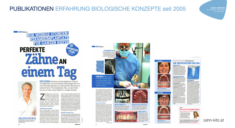 Feste-Zähne-Sofort: Versorgung mit CAD-CAM, abdruckfrei - Dr. Robert Bauder, MSc., MSc. - Zahnarzt Kitzbühel 6370