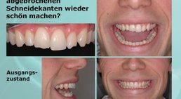 Ästhetische Behandlungen und Sanierungen -