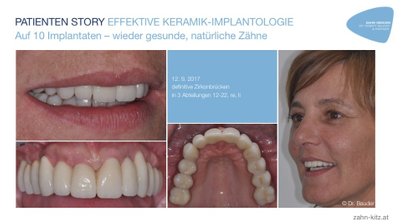 Ästhetische Behandlungen und Sanierungen