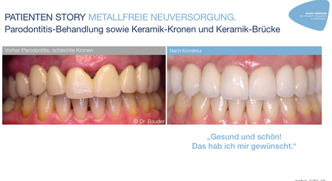 Dr. Robert Bauder, MSc., MSc. - Zahnarzt Kitzbühel 6370