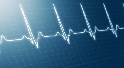Herzrhythmusstörungen