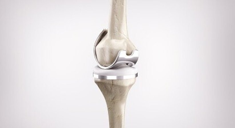 Hüft- und Knieendoprothetik sowie komplexe Revisionsoperationen im Hüft- und Kniebereich - Priv.-Doz. DDr. Maximilian Kasparek, MSc - Orthopäde Wien 1180
