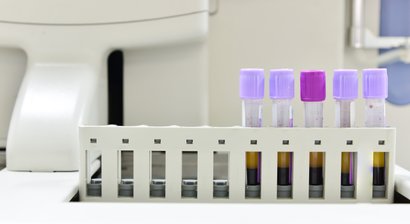 ACP-Therapie (Eigenblutbehandlung)