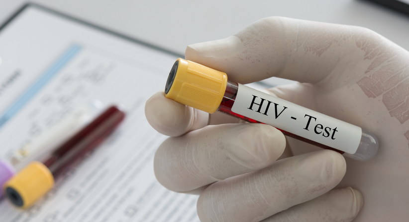 HIV, PrEP, PEP - Dr.med.univ. Michael Skoll - Hautarzt Wien 1110