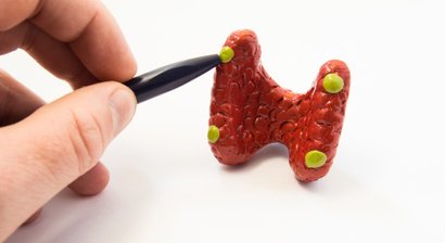 Erkrankungen der Nebenschilddrüsen