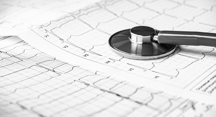 Ruhe-EKG - Dr. Felix Knöbel - Endokrinologe Wien 1230