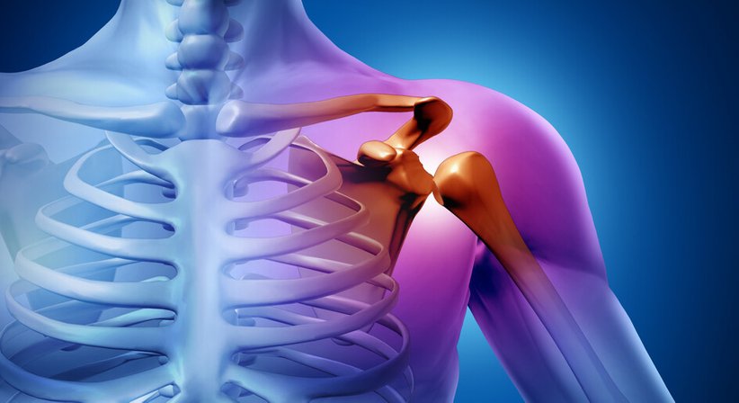 Schulterluxation / Schulterinstabilität - OA Dr. Dominik Meraner - Orthopäde Hornstein 7053