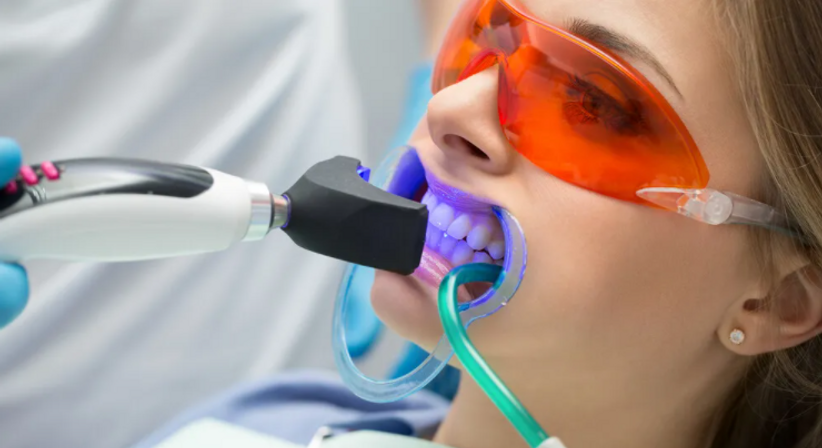 Veneers und Bleaching - DDr. Ronald Ringl - Zahnarzt Wien 1030