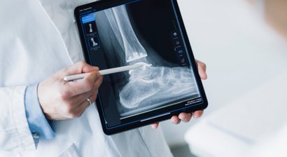 Sprunggelenksendoprothese (Künstlicher Gelenkersatz)