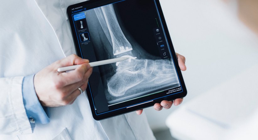 Sprunggelenksendoprothese (Künstlicher Gelenkersatz) - Dr. Lukas Fraißler - Orthopäde Gröbming 8962