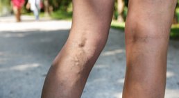 Dr. Ernst Wandl - Radiologe Linz 4020