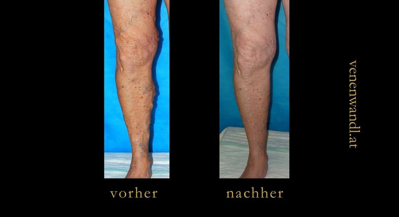 Dr. Ernst Wandl - Radiologe Linz 4020