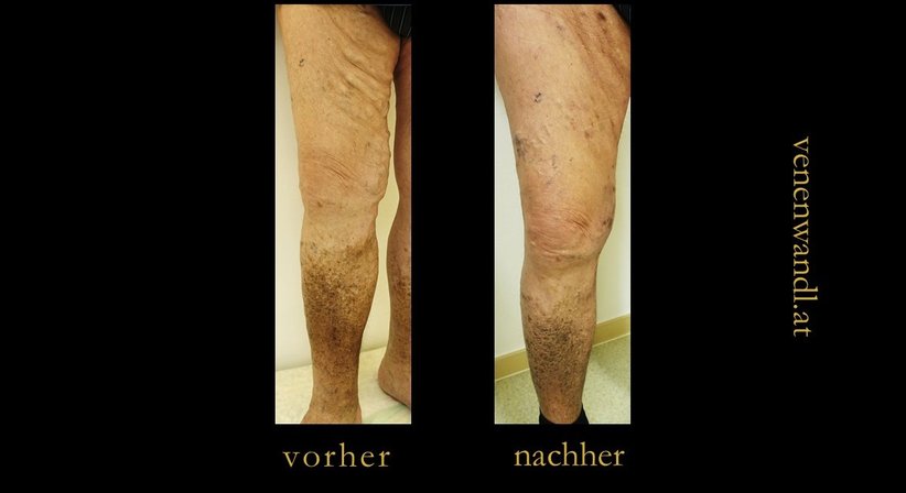 Dr. Ernst Wandl - Radiologe Linz 4020